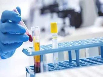 AHCC Kho Kab Mob HPV Thiab Cervical Cancer?
