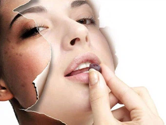 Monobenzone Thiab Glutathione Uas Zoo Rau Cov tawv nqaij dawb?